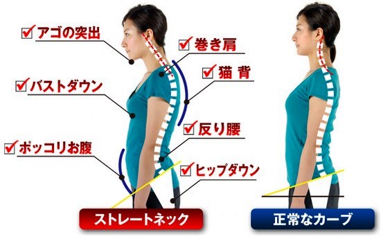 ストレートネックと正常なカーブの違い